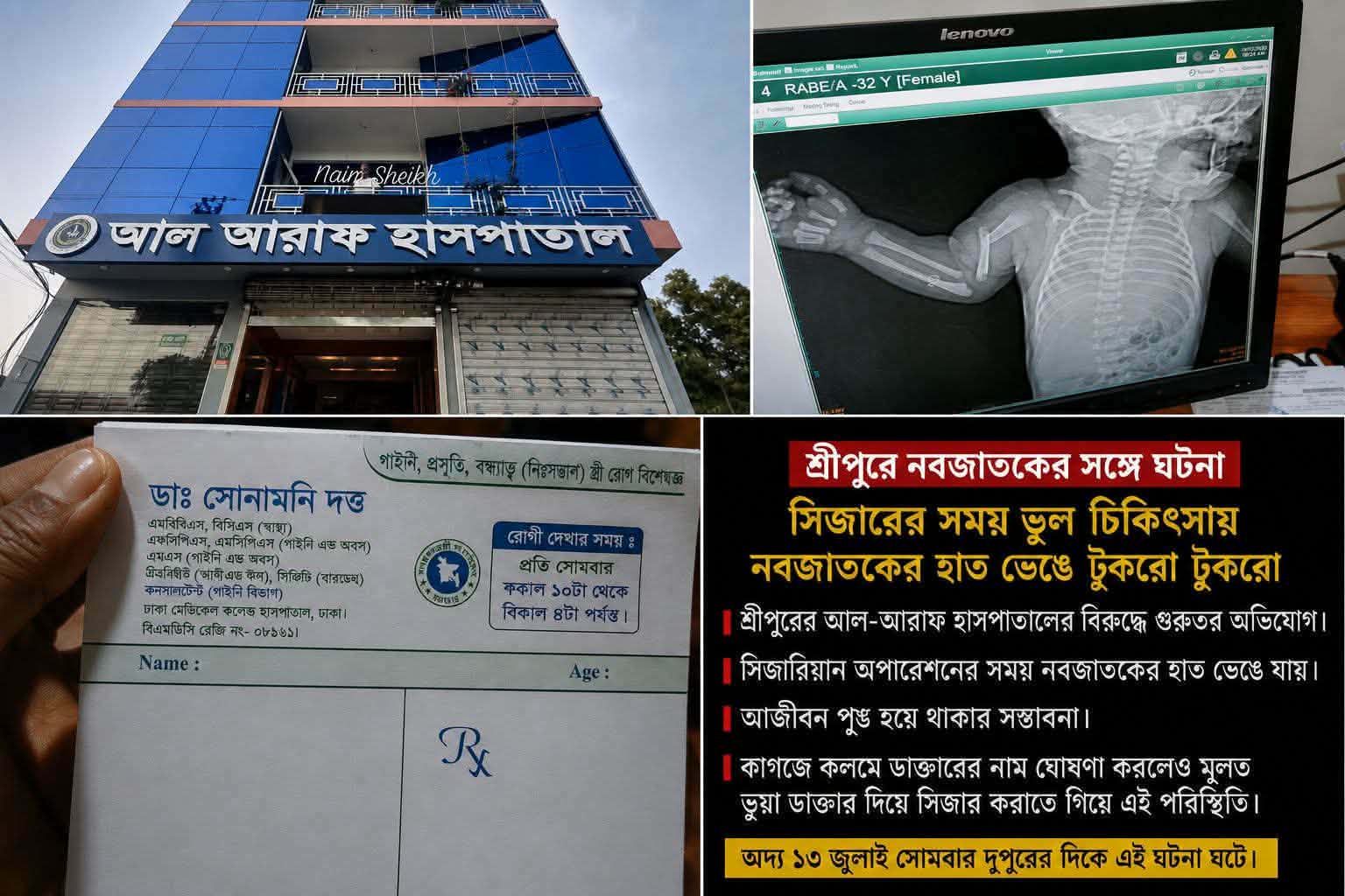 শ্রীপুরে সিজার করতে গিয়ে নবজাতকের হাত ভেঙ্গে কয়েক টুকরো, সিভিল সার্জন কতৃক তদন্ত কমিটি গঠন